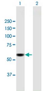 CDADC1 Polyclonal Antibody, MaxPab™