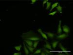 CDADC1 Polyclonal Antibody, MaxPab™