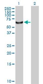 CDADC1 Antibody in Western Blot (WB)