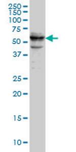 CDADC1 Monoclonal Antibody (1A2)