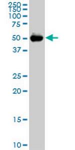 CDADC1 Monoclonal Antibody (2E8)