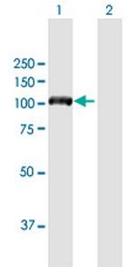 DIAPH3 Antibody in Western Blot (WB)