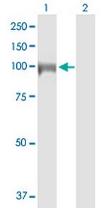 DIAPH3 Polyclonal Antibody, MaxPab™