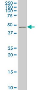 TSC22D4 Antibody in Western Blot (WB)