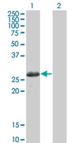 TSSK3 Monoclonal Antibody (3G8)