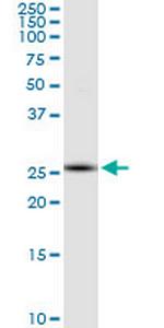 RNF170 Monoclonal Antibody (2D6)