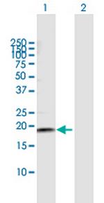 NETO2 Antibody in Western Blot (WB)