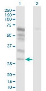 NETO2 Antibody in Western Blot (WB)
