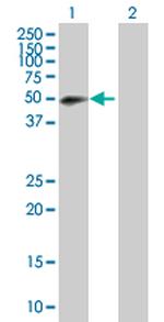 RNF146 Polyclonal Antibody, MaxPab™