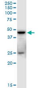 SHARPIN Polyclonal Antibody, MaxPab™