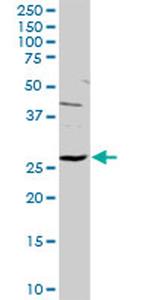 HYI Antibody in Western Blot (WB)