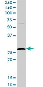 HYI Antibody in Western Blot (WB)