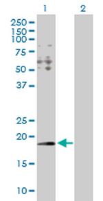 HYI Polyclonal Antibody, MaxPab™