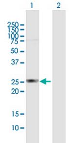 HDHD3 Polyclonal Antibody, MaxPab™