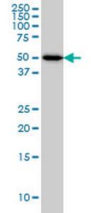 ADPGK Monoclonal Antibody (1E4)