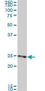 RAB33B Monoclonal Antibody (6F4)