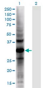 AKR1CL2 Monoclonal Antibody (1C8)