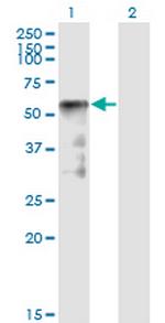 SESN2 Monoclonal Antibody (1A12)