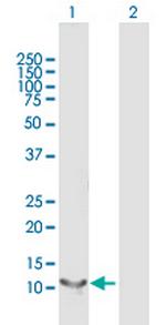 RBP5 Polyclonal Antibody, MaxPab™