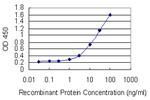 RBP5 Monoclonal Antibody (4B5)