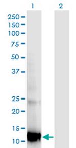 RBP5 Monoclonal Antibody (2D1)