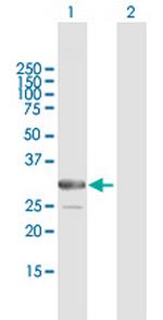 ARMC10 Antibody in Western Blot (WB)