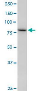 SETDB2 Monoclonal Antibody (2F4)