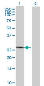 SPATA9 Antibody in Western Blot (WB)