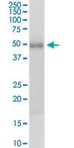 TSSK1B Antibody in Western Blot (WB)
