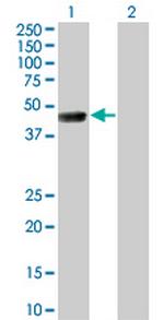 TSSK1B Monoclonal Antibody (4F12)