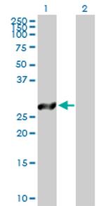 TSSK6 Polyclonal Antibody, MaxPab™