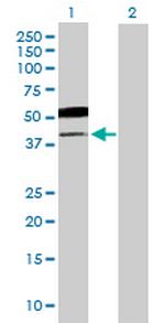 B3GNT5 Polyclonal Antibody, MaxPab™