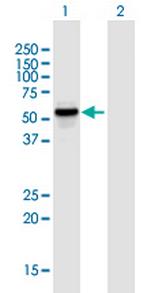 KATNAL1 Polyclonal Antibody, MaxPab™