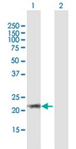 ARL6 Polyclonal Antibody, MaxPab™
