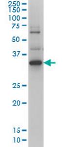 ZIC4 Monoclonal Antibody (4B1)