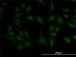 ZIC4 Monoclonal Antibody (1A9)