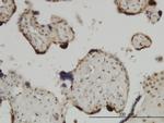 ZIC4 Antibody in Immunohistochemistry (Paraffin) (IHC (P))