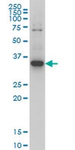 ZIC4 Antibody in Western Blot (WB)