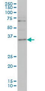 ZIC4 Monoclonal Antibody (3D5)