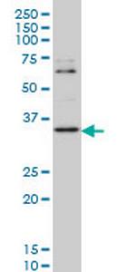 ZIC4 Monoclonal Antibody (2C2)