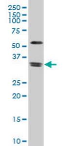 ZIC4 Monoclonal Antibody (3G4)