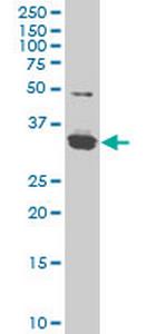 ZIC4 Monoclonal Antibody (4F3)