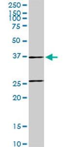 RUNDC2A Antibody in Western Blot (WB)