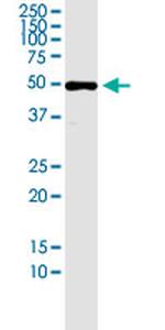 SLC7A6OS Antibody in Western Blot (WB)