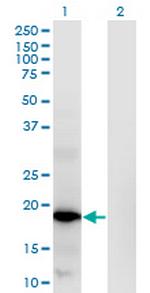 RNASEH2C Monoclonal Antibody (5D6)