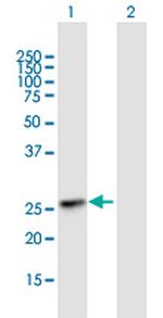 KIAA1109 Antibody in Western Blot (WB)
