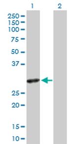 SLA2 Polyclonal Antibody, MaxPab™