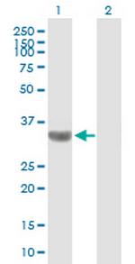 TBC1D3 Antibody in Western Blot (WB)
