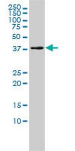 MGC3207 Monoclonal Antibody (2D11-1G4)