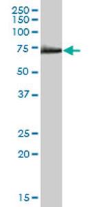 CAMKK1 Antibody in Western Blot (WB)